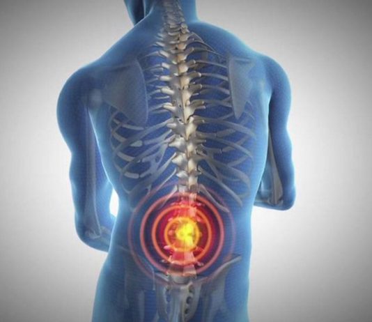 Cuidado: detrás de una lumbalgia crónica puede esconderse una enfermedad discapacitante
