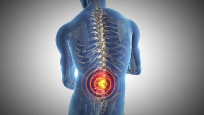 salud-lumbalgia-sintomas-pacientes-jovenes