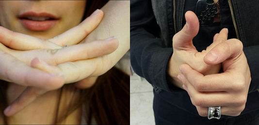 ¿Es malo crujirse los dedos?