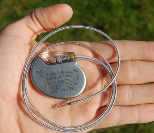 Lo que tenés que saber sobre los marcapasos hackeables