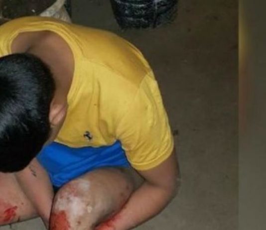 Un pitbull mordió a ladrón que intentó robar la casa