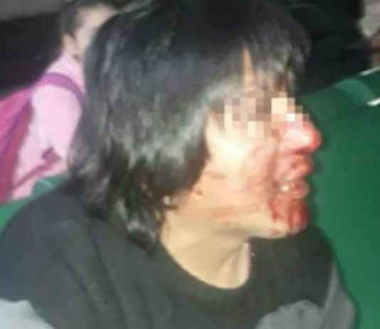 Tocó a una mujer en el subte y recibió tremenda paliza