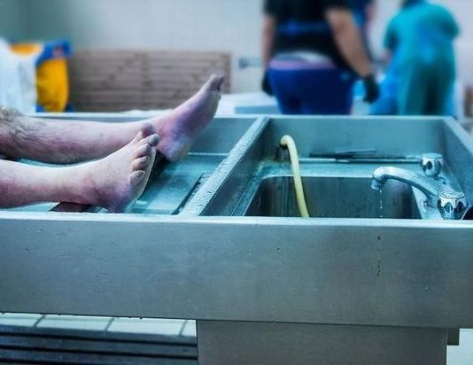 Estaba “muerto”, despertó en la morgue y volvió a la fiesta donde sufrió un coma