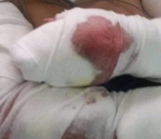 Una mujer está grave tras ser atacada por tres perros