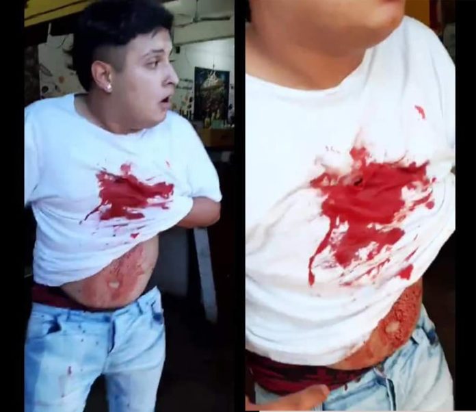 Se entregó el acusado de dispararle a un joven en Tafí Viejo_5dcaf34b4400d.jpeg