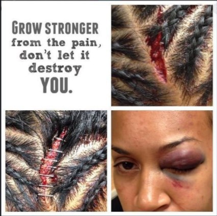 FALLON FOX