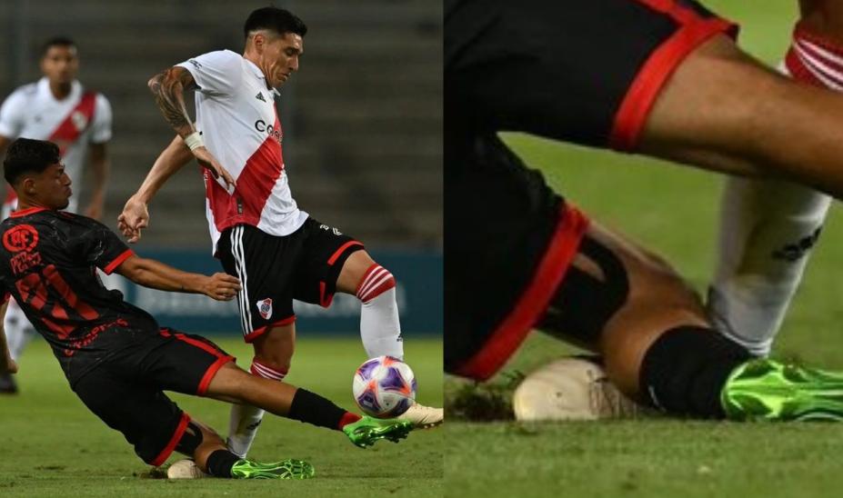 Kranevitter se fracturó el tobillo: así fue la brutal patada que lo lesionó