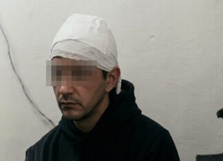 Yerba Buena: golpearon salvajemente a un adolescente de 14 años