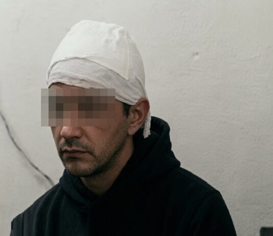 Yerba Buena: golpearon salvajemente a un adolescente de 14 años